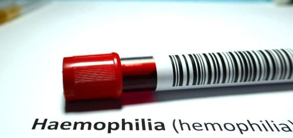 Hemofilia