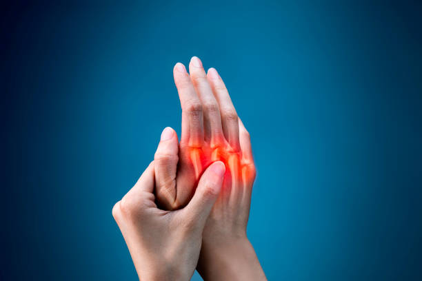 Artritis Reumatoide